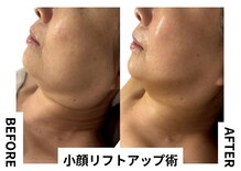 シェリートーキョー 成田店(Cherie Tokyo)