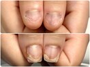 深爪解消♪自爪風長さだし