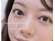 ランリ (Ranri)の写真/圧倒的人気なまつ毛パーマで垢抜け目元へ。メイク時短も叶い、ナチュラルに盛れるお目元へ★