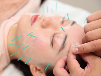 ボディラボ鍼灸整骨院(BODY LAB.鍼灸整骨院)の写真/極細の鍼のみ使用！低刺激にこだわった美容鍼/鍼療法】はじめての方も◎マンツーマン施術