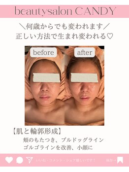 ビューティーサロン キャンディ 海老名(Candy)/