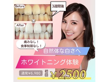 ホワイトニングショップ 泉佐野店