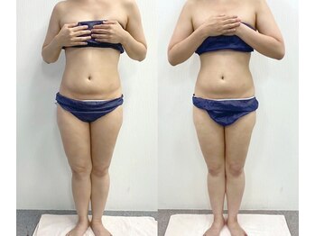 アイリーボーテ 東大阪(アイリーBEAUTE)/痩身