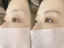 プラティーヌ 広尾 恵比寿(Platine)/横顔も美しい立体感デザイン