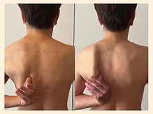 ラフリー 仙台院(RUFFREE)/肩こり改善に肩甲骨はがし