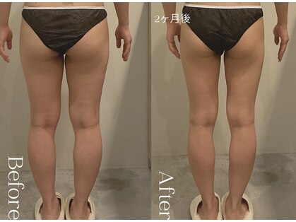 ユーフォリア グロウ(euphoria glow)の写真