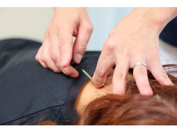 はやし整骨院 鍼灸院/鍼灸施術
