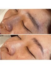 ママナ(mamana)/メンズアイブロー