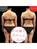 夏痩せくびれ作り【セルライトゼロ2】二の腕・上半身痩せ90分¥16500→¥8250