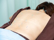 ひかり鍼灸整骨院/施術時は専用のお着替えをご用意