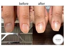 ティアレ(tiare)/施術例