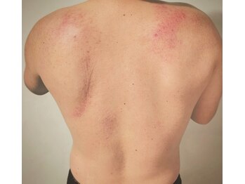 イニティウム 清澄白河(initium)/【スライドカッピング　男性】