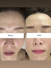 ジョーヌ(JAUNE)/お肌で印象激変！