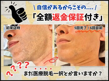 毛抜き屋 可児店/どんなに剛毛でもお任せください