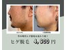 都度払い【メンズ】髭脱毛（美容パック付）