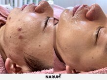 ナルムフェイシャル 代々木(NARUM facial)の雰囲気（男性にも人気です◎）