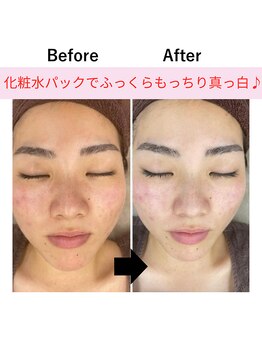 オリオンドットエスツー(Orion.S2)/【Before→After】