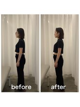 美容整体プラスフィール 恵比寿本店/姿勢矯正・猫背改善