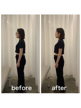 美容整体プラスフィール 恵比寿本店/姿勢矯正・猫背改善