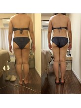 グラン ジュテ/筋膜ラジオ波ンドとMキューブ