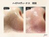 毛穴入門編☆頑固な毛穴汚れに☆ハイドロヴィーナス毛穴洗浄¥8000→￥4500