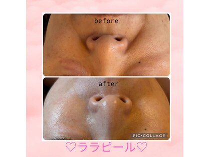 リリアン(Re Lien)の写真