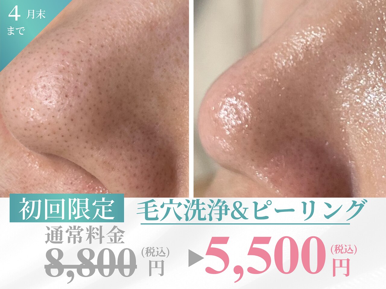 【毛穴さよなら♪】ゴッソリ毛穴洗浄&全顔ピーリング&90分\8800→\5500