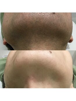 メンズサロンエヌエー(MEN'S SALON NA)/頑固なヒゲもお任せあれ!