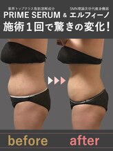 蓮子の夢/施術1回で驚きの変化！