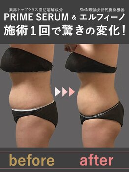 蓮子の夢/施術1回で驚きの変化！