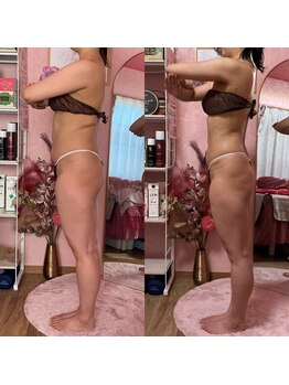 ポノ(Pono)/【部位痩せ】不可能じゃない!!