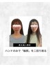 最先端小顔術×オプションプラス1-80分-回数券お持ちのお客様メニュー
