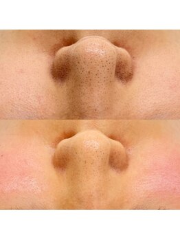 クム(kumu)/水光肌Wax◎