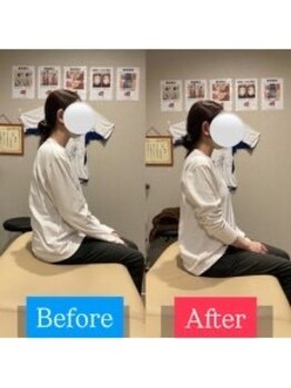 ナオル整体 宮崎院(NAORU整体)/30代女性施術事例【猫背改善】