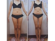 大幅減量も大得意♪EMS/ラジオ波/ドームサウナ/痩身