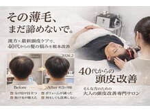 マイントゥー(mine too)