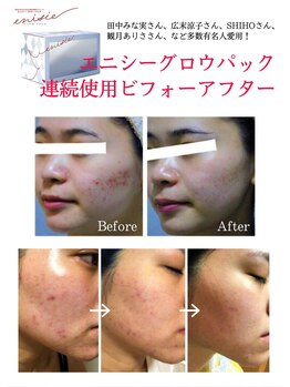 セラピエージ/肌老化リセットで夢の透明美肌へ