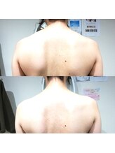 RiとBiのたまご/(ブライダル)引き締め