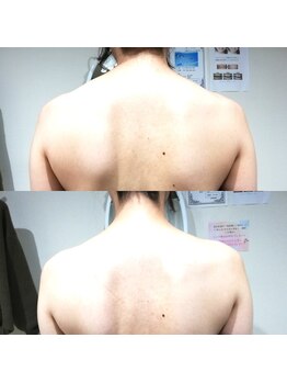 RiとBiのたまご/(ブライダル)引き締め