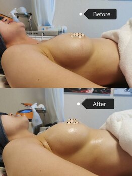 シークレット(Secret)/20代のお客様ビフォーアフター