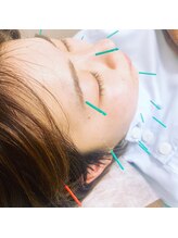 レメディ/美容鍼スペシャルコース