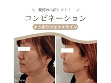 クリニカルエステ リフィーナ 辻堂店の雰囲気（コンビネーション引き締めリフトケアお任せください）