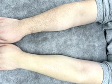 サロン ド レーヴ(Salon de Reve)/ビフォーアフター