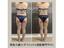 ミノ 美里大通り店(mino)/ダイエットパッケージ