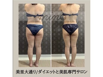 ミノ 美里大通り店(mino)/ダイエットパッケージ
