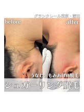 グランクレール トウキョウ(GRANDCLAIRE.TOKYO)/うなじシュガーリング