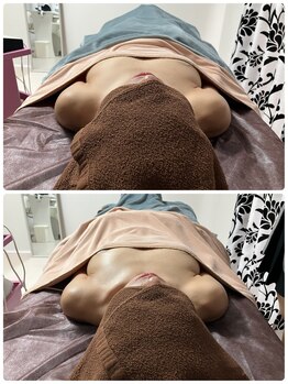 ルミエール(Lumiere)/【倉敷市】バストアップ施術事例