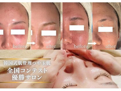 マノマノ エミュー(manomano emu)の写真