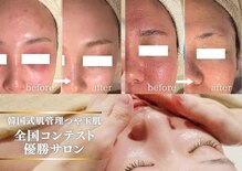 マノマノ エミュー(manomano emu)