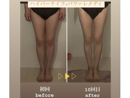 ベルフィーヌ(BELLEFINE)の写真